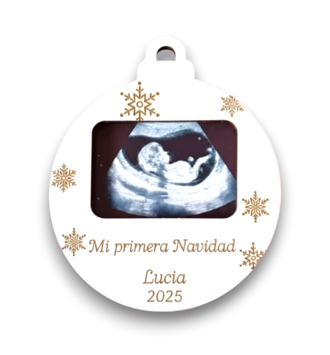 BOLA DE NAVIDAD PARA ECOGRAFÍA